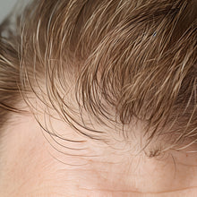 Men's Hair Loss, Bald Spot Recovery, & Beard Growth Microneedling Pen Kit