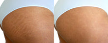 iLLUMAPRO Stretchmark Camouflage Tattoo Kit